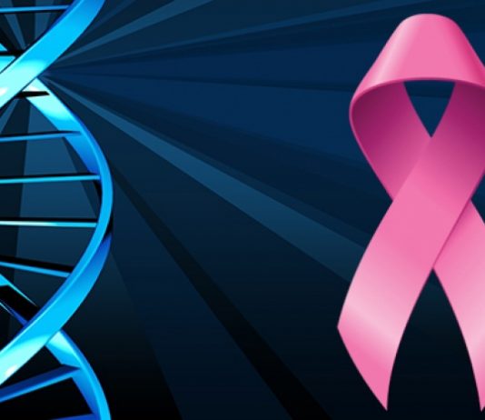Καρκίνος Μαστού: Εγκρίθηκε το πρώτο ευρείας χρήσης γονιδιακό τεστ