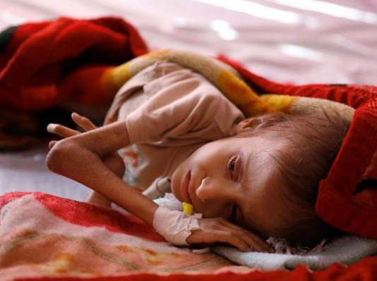 Κίνδυνος λιμοκτονίας για 5,2 εκατ. παιδιά στην Υεμένη